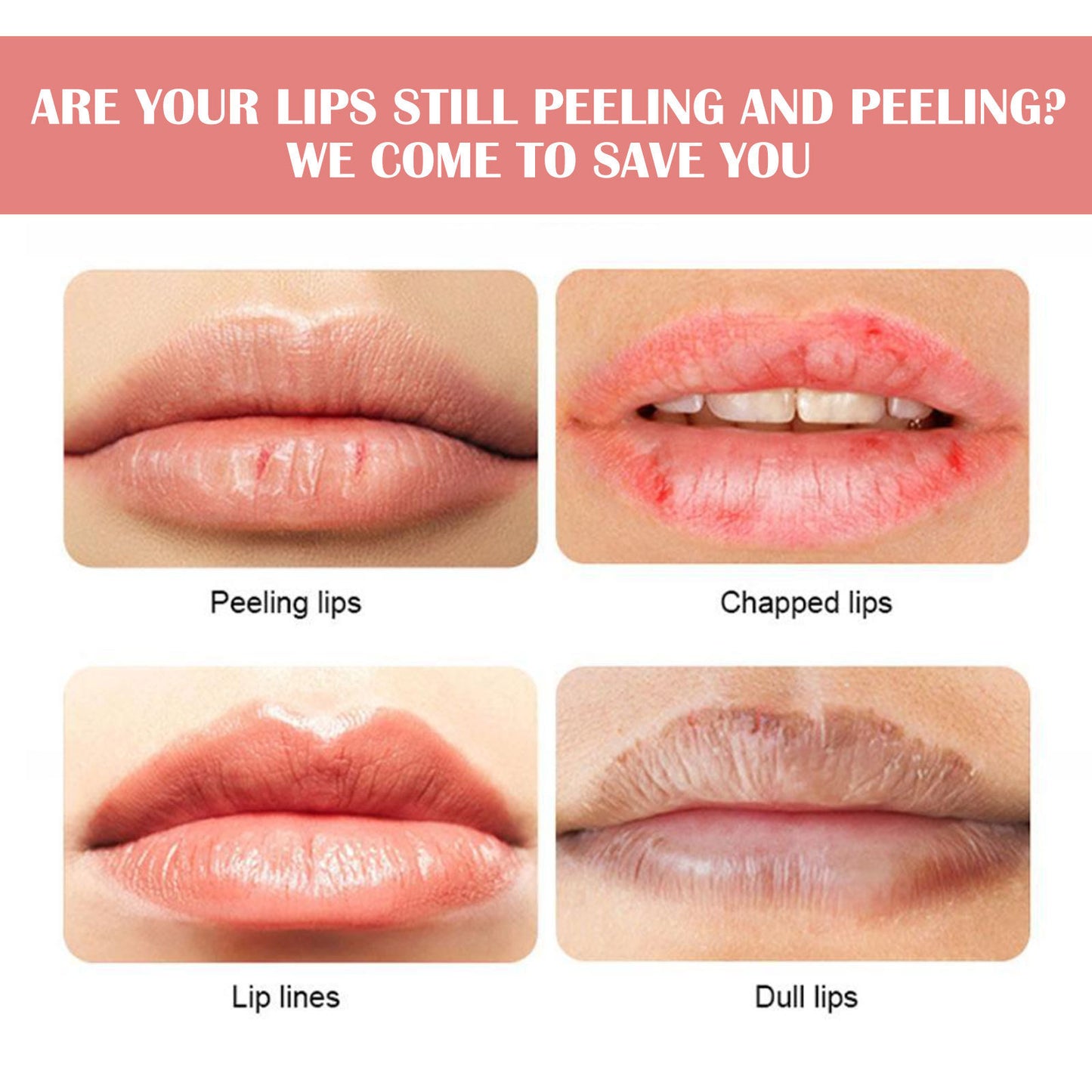 Watermelon Flavor Lip Balm Hydrating Freeze-dried Cracking
